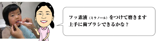 フッ素液をつけて磨きます。上手に歯ブラシできるかな?